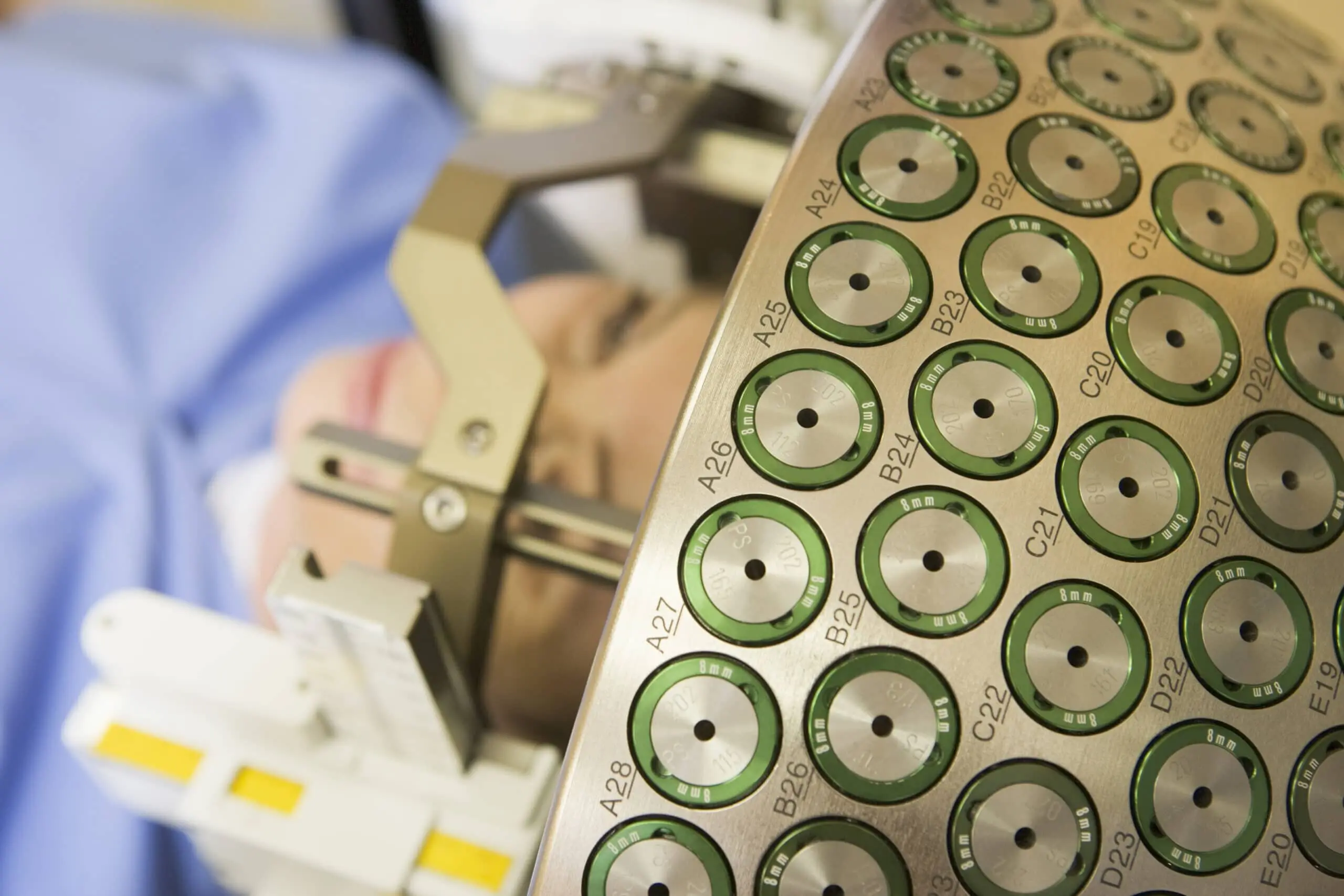 gamma-knife-surgery-scaled