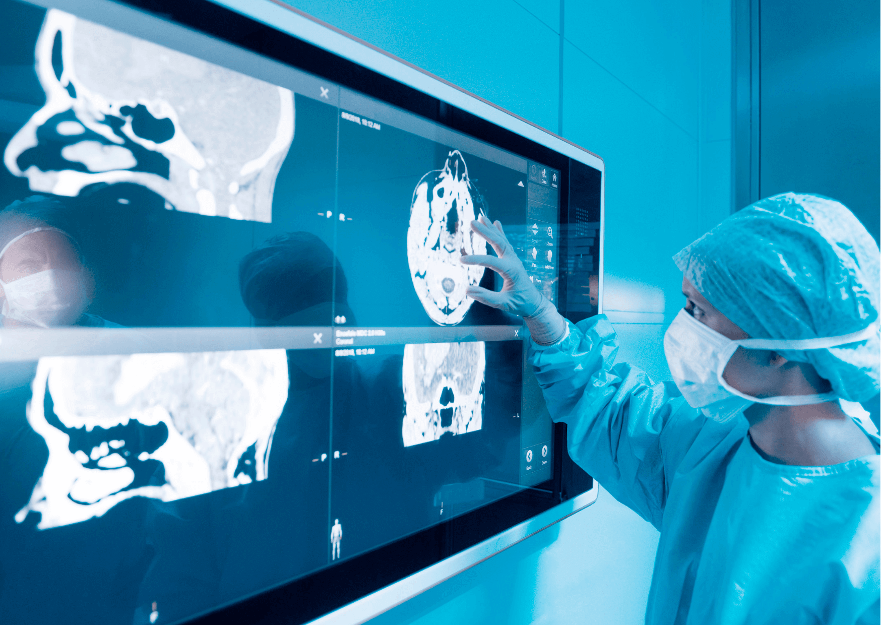 neuronavigation